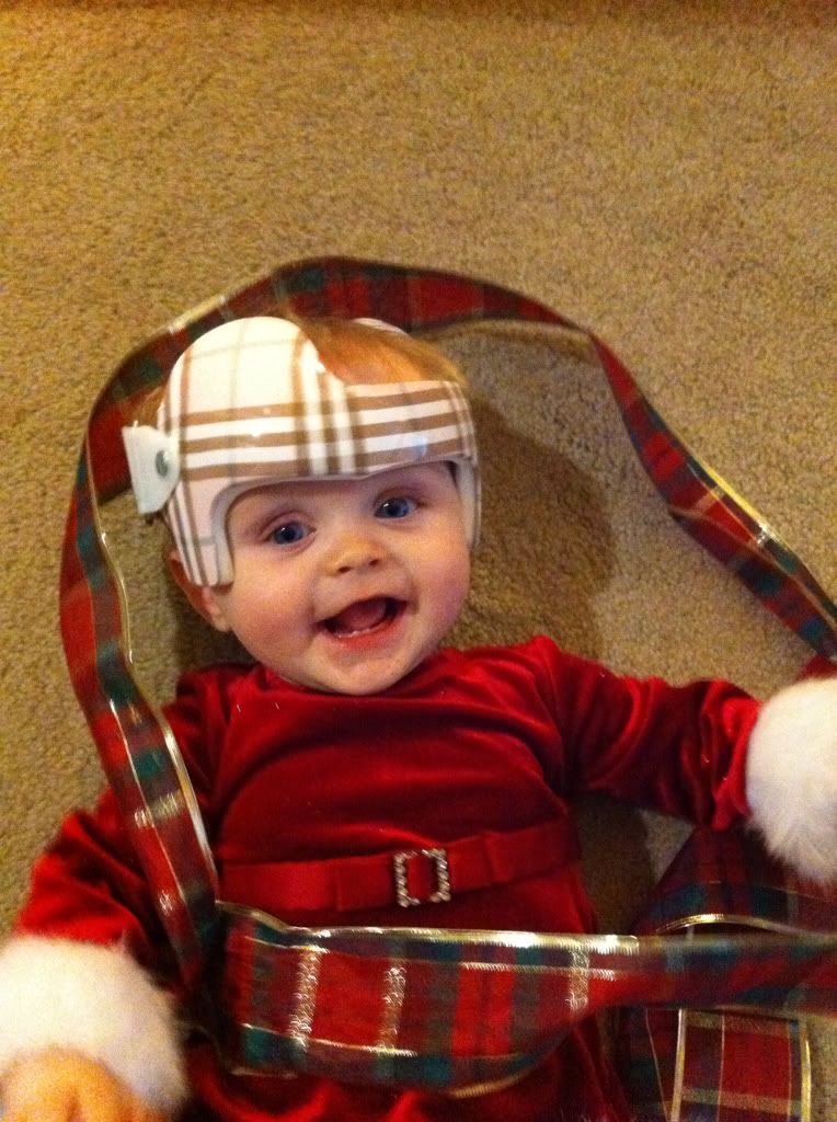 Show me your baby's helmet! BabyCenter