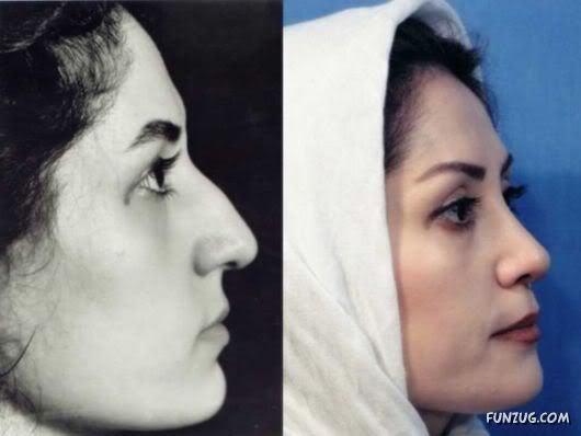 Plastic surgery in pakistan islamabad