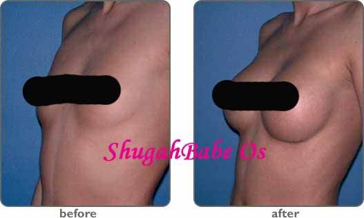 Breast Actives